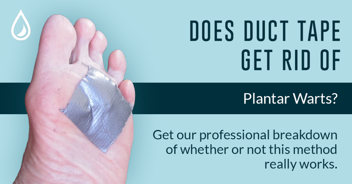 Plantar Warts And Duct Tape: What You Should Know