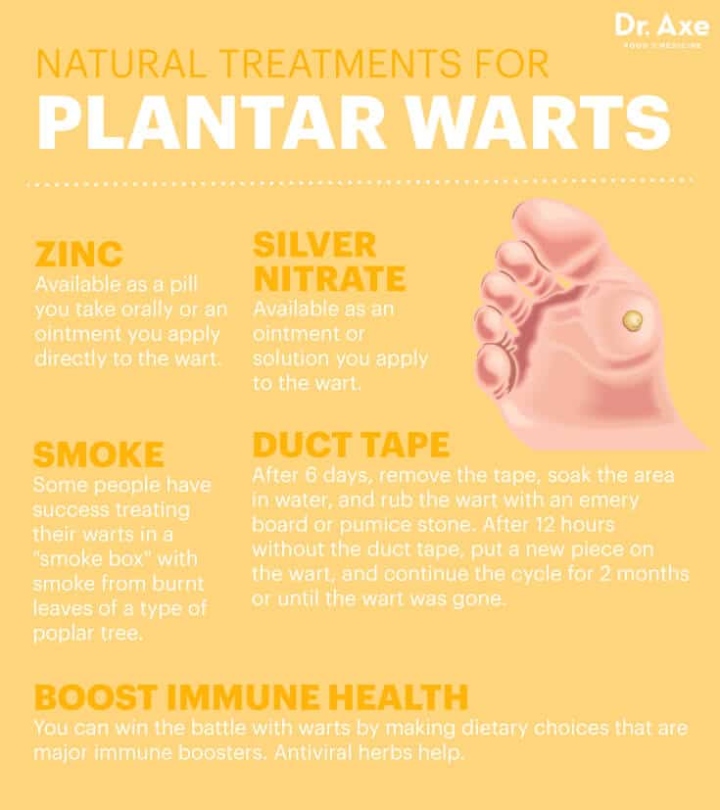 Stop Plantar Warts In Their Tracks With Natural Remedies - Dr